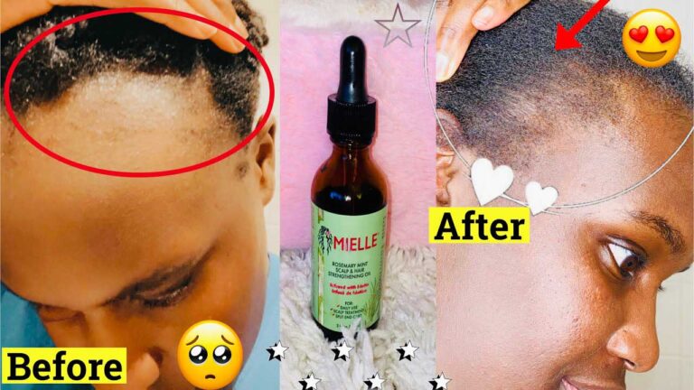 Mielle Hair Oil The Rosemary Mint Scalp & Hair Strengthening Oil, is a well-known product from Mielle Organics