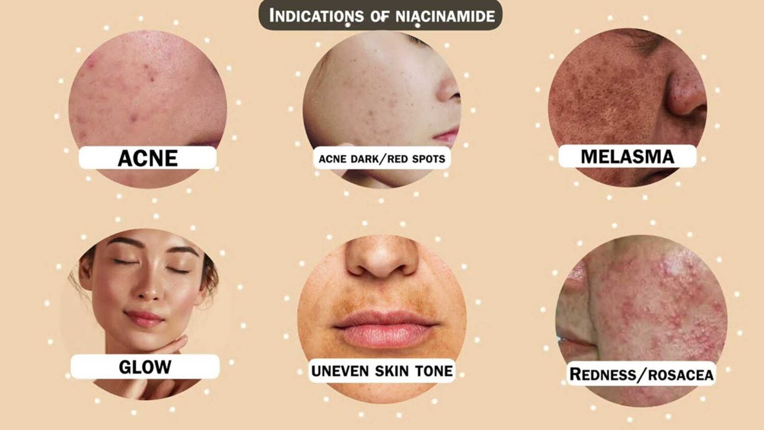 Niacinamide Your Guide to a Versatile Skincare Ingredient (1)
